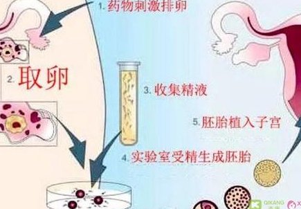 焦作市妇幼保健院试管婴儿谁做的好？怎样选择适合自己的医生？