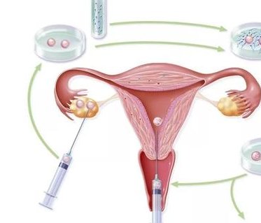 试管婴儿时间是什么时候？什么时候做试管婴儿好？