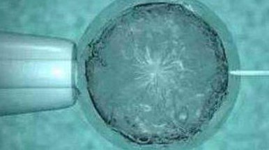 三代试管婴儿多少钱？单三代试管婴儿费用